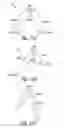Fig. 13 - Bone fixation device and method