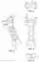 Fig. 03 - Expanding plug for tendon fixation