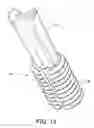 Fig. 06 - Expanding plug for tendon fixation