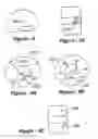 Fig. 04 - Methods for treating a defect in the annulus fibrosis