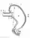 Fig. 06 - Method and device for use in endoscopic organ procedures