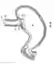 Fig. 07 - Method and device for use in endoscopic organ procedures