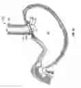Fig. 08 - Method and device for use in endoscopic organ procedures