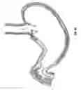 Fig. 09 - Method and device for use in endoscopic organ procedures