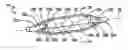 Fig. 01 - Device and method for collapsing an angioplasty balloon