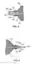 Fig. 04 - Polymer marker and retention bands