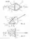 Fig. 02 - Embolic filtering devices