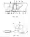 Fig. 03 - Expandable emboli filter and thrombectomy device