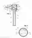 Fig. 03 - Earwax extracting apparatus and method comprising same