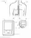 Fig. 01 - Neurostimulation therapy usage diagnostics