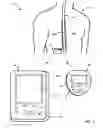 Fig. 02 - Neurostimulation therapy usage diagnostics