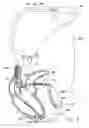 Fig. 06 - Mode switching heart stimulation apparatus and method