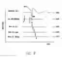 Fig. 10 - Mode switching heart stimulation apparatus and method