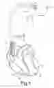 Fig. 02 - Multi-variable feedback control of stimulation for inspiratory facilitation