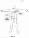 Fig. 02 - Implantable medical device with inductive coil configurable for mechanical fixation