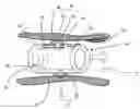 Fig. 01 - Lumen-traveling device