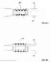 Fig. 09 - Lumen-traveling device