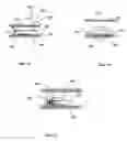 Fig. 13 - Lumen-traveling device