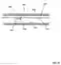 Fig. 25 - Lumen-traveling device