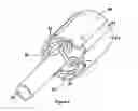 Fig. 07 - Dilating lead tip