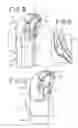 Fig. 05 - APPARATUS FOR LEAD PLACEMENT ON A SURFACE OF THE HEART