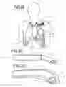 Fig. 09 - METHODS FOR LEAD PLACEMENT ON A SURFACE OF THE HEART