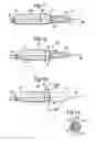 Fig. 05 - Stent positioning system