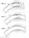 Fig. 03 - Bioerodible endoprostheses and methods of making the same