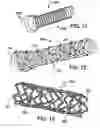 Fig. 08 - Bioerodible endoprostheses and methods of making the same
