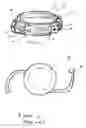 Fig. 02 - Accommodating intraocular lens