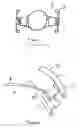 Fig. 03 - Accommodating intraocular lens