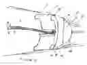 Fig. 04 - Accommodating intraocular lens