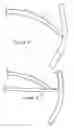 Fig. 06 - Accommodating intraocular lens
