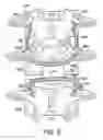 Fig. 06 - Facet joint and spinal ligament replacement