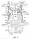 Fig. 08 - Facet joint and spinal ligament replacement