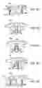 Fig. 09 - Facet joint and spinal ligament replacement