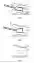 Fig. 02 - Devices and methods for the treatment of bone fracture