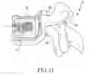 Fig. 12 - Bone replacement material