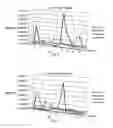 Fig. 05 - Method for analysing signals containing pulses