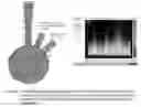 Fig. 06 - PROCESS FOR IDENTIFICATION OF NOVEL DISEASE BIOMARKERS IN MOUSE MODELS OF ALZHEIMER'S DISEASE INCLUDING TRIPLE TRANSGENIC MICE AND PRODUCTS THEREBY