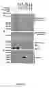 Fig. 06 - Parkin interacting polypeptides and methods of use