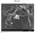 Fig. 05 - Carbon nanotube functionalized with osmium clusters and process for preparing same