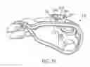 Fig. 20 - Headgear connection assembly for a respiratory mask assembly