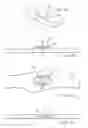 Fig. 05 - Head Gear Fitting System