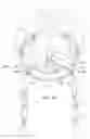 Fig. 16 - Head Gear Fitting System