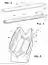 Fig. 03 - METHOD, APPARATUS AND KIT OF APPARATUS FOR COSMETICALLY TREATING AREAS OF HAIR LOSS
