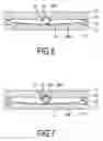 Fig. 04 - Foundation shock eliminator