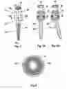 Fig. 02 - Anchoring element for fixing a rod of a device for setting a human or animal spinal column to a vertebra