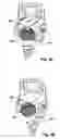 Fig. 03 - Anchoring element for fixing a rod of a device for setting a human or animal spinal column to a vertebra