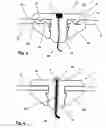 Fig. 03 - Device for fastening a sensor on containers